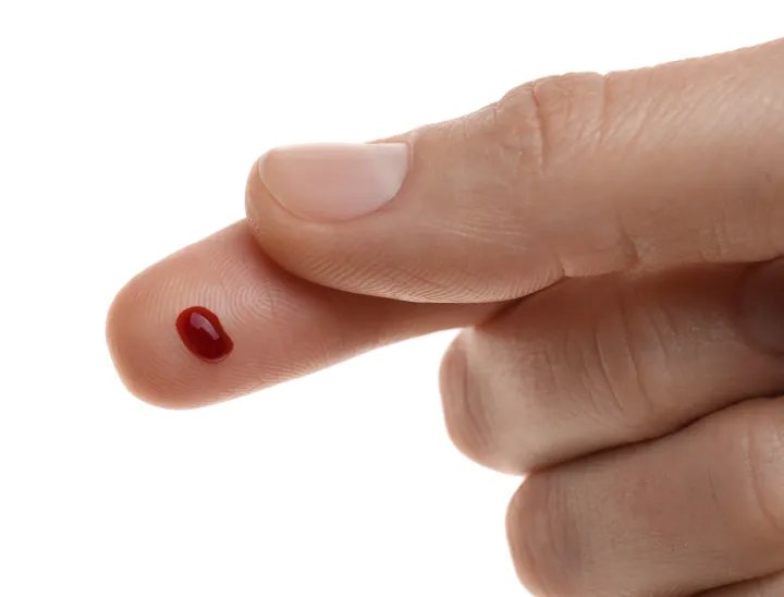 Fingerbeere für die Blutanalyse